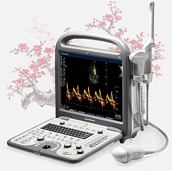 Ультразвуковой сканер Sonoscape S8